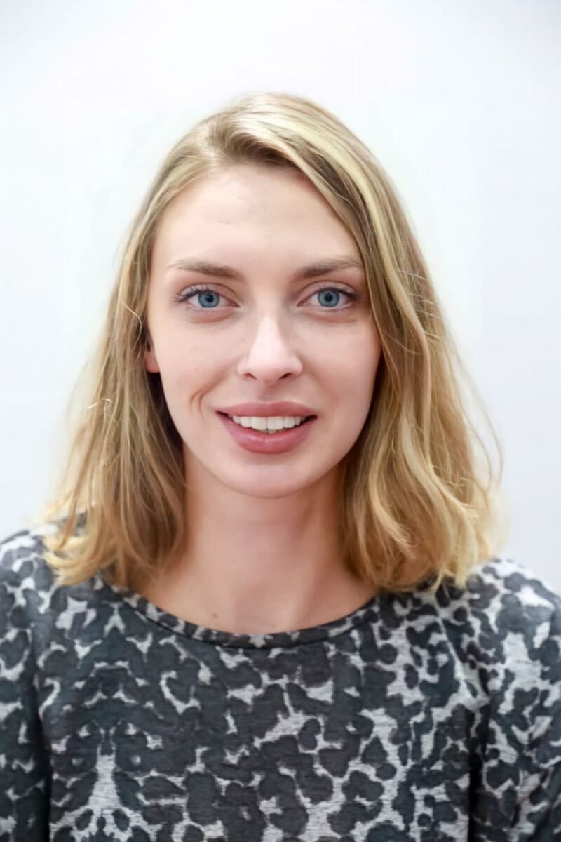 upper veneers
