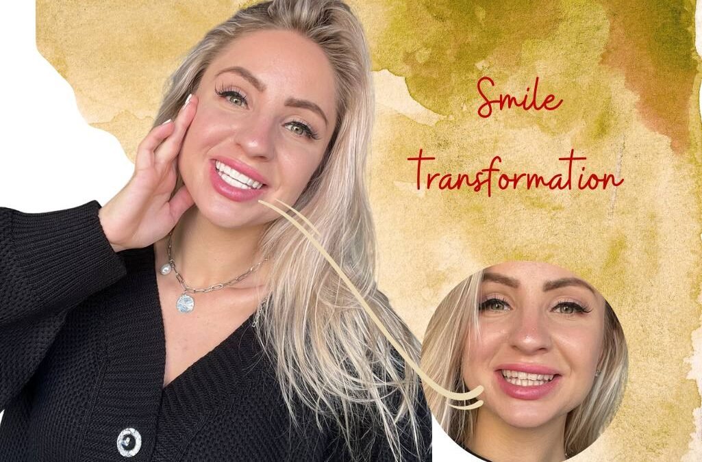smile transformation