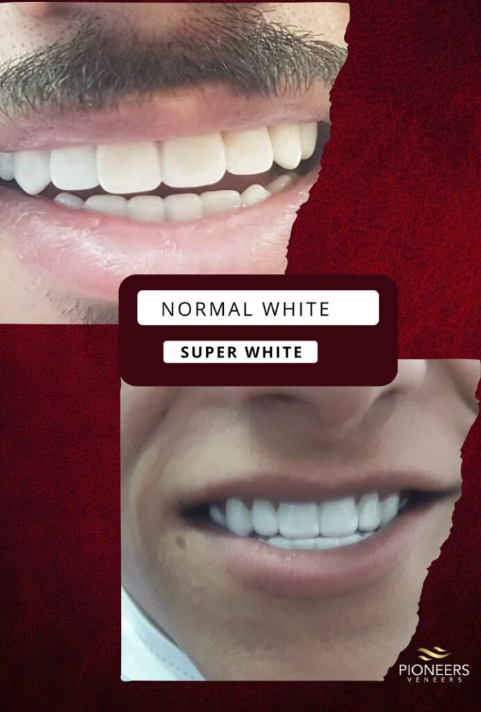 super white vs normal white
