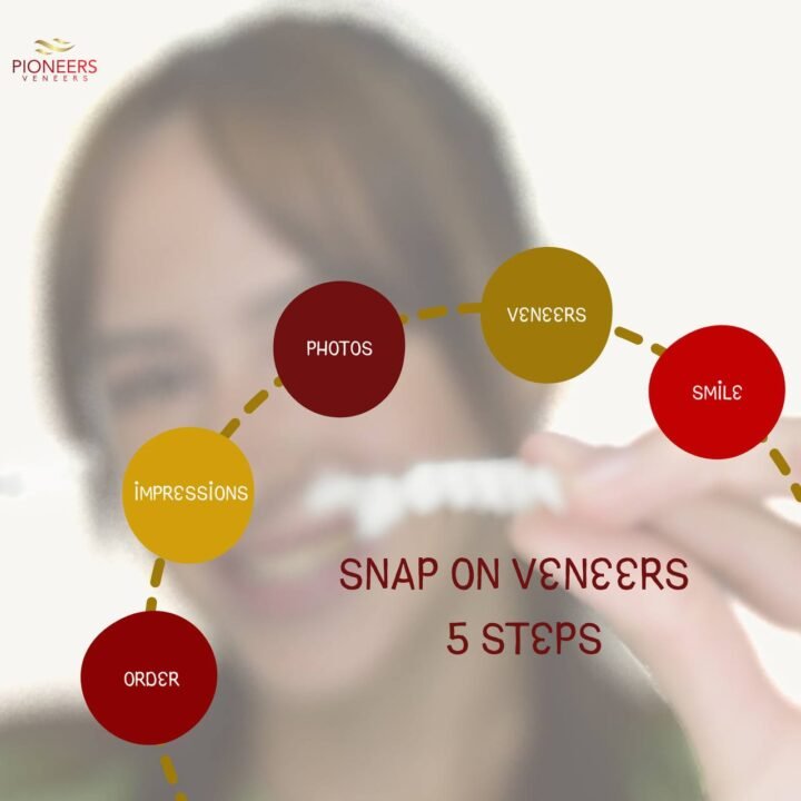 snap on veneers steps