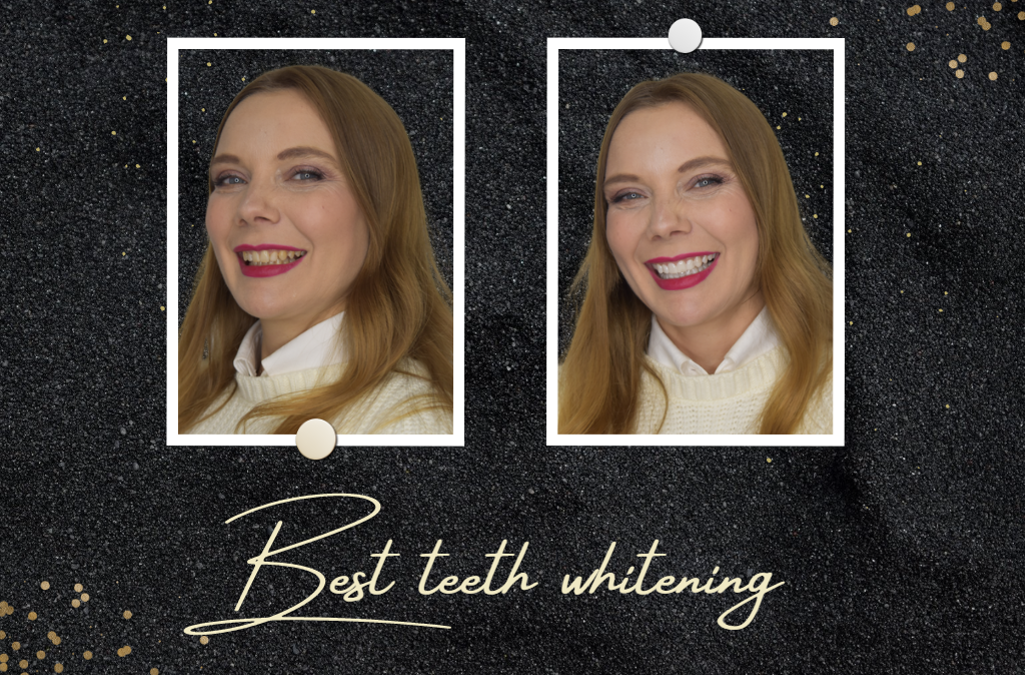 Best teeth whitening