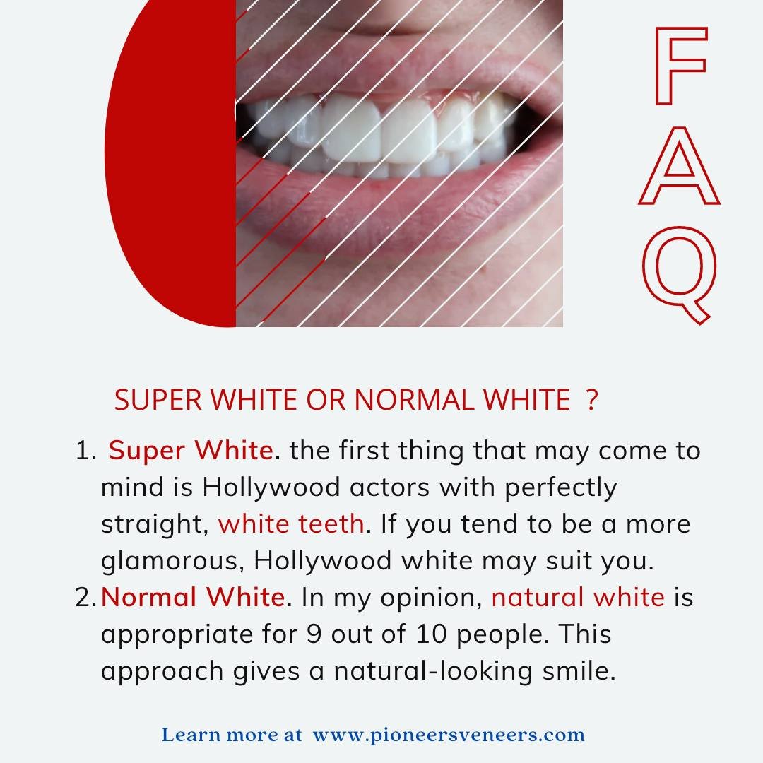 Best Snap On Veneers 2024 Snap On Veneers