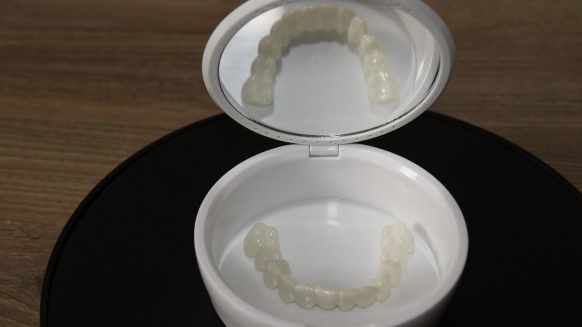 snap on veneers