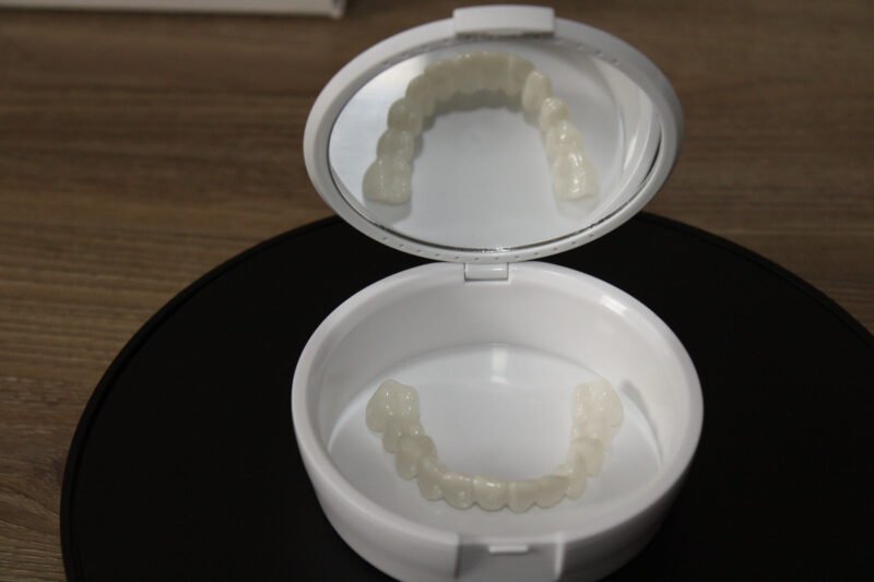 Top and Bottom Veneers Set - Image 3